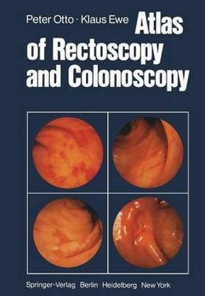 Atlas of Rectoscopy and Coloscopy