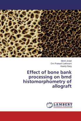 Effect of bone bank processing on bmd histomorphometry of allograft