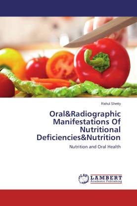 Oral&Radiographic Manifestations Of Nutritional Deficiencies&Nutrition ...