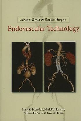 Modern Trends in Vascular Surgery: Endovascular Technology