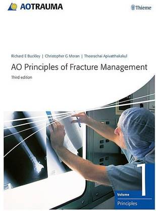 AO Principles of Fracture Management