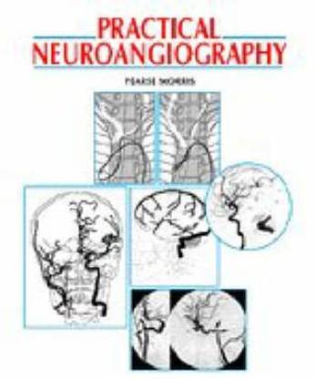 Practical Neuroangiography