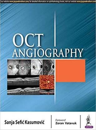 OCT Angiography