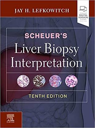 Scheuer's Liver Biopsy Interpretation