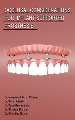 Occlusal Considerations For Implant Supported Prosthesis
