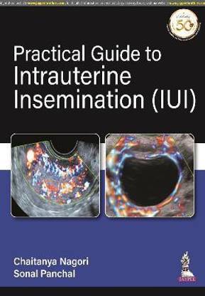 Practical Guide to Intrauterine Insemination (IUI)