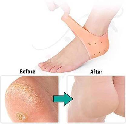 HDCraft Gel Heel Protectors DK=658 Heel Guards Heel Spur Relief Heel Booties(PACK OF 1) Heel Support