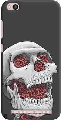 SP KING Back Cover for Mi Redmi 5A