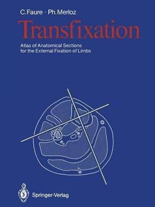 Transfixation