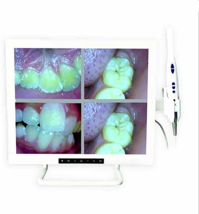 Unicorn DenMart Accuvue CMOS 12 megapixel HD Waterproof Intraoral Camera with 17" LCD Screen Retinal Fundus Camera