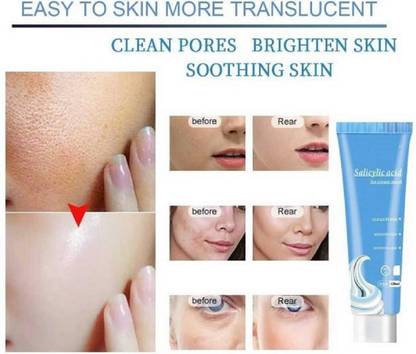 ShopCircuit Best Quality Ice Cream Mask Clean Pores, in+ Salicylic Acid Ultra Cleansing Mask Ice Cream Mask Gel Blackheads Remover| Pore Cleansing and Shrinking