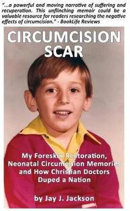 Circumcision Scar
