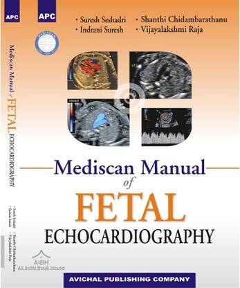 Mediscan Manual Of Fetal Echocardiography