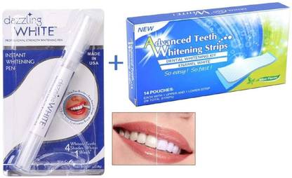 Digital Shoppy Dazzling White Instant Teeth whitening pen And Advanced Prefessional Teeth Whitening Strips Teeth Whitening Kit