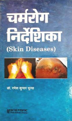 स्किन डिज़ीज़ेज़ (चार्म रोग निर्धेशीका) बेस्ट बुक फॉर स्किन डिसीज़ विथ इमेजेस एंड एक्सप्लेनेशन इन हिंदी
