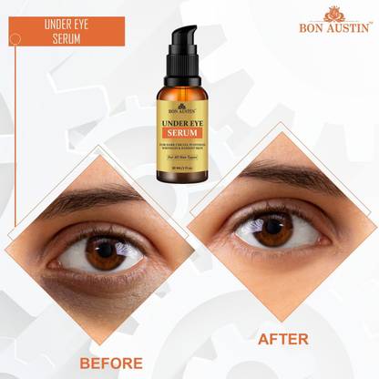 Bon Austin Premium Under Eye Serum To Reduce Dark Circles and Puffiness (30 ML)