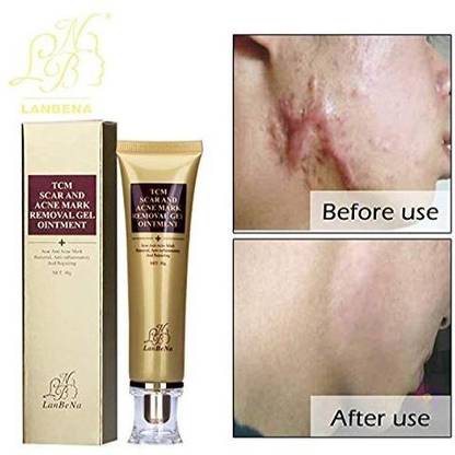 LANBENA Acne Scar Mark Removal Gel Ointment