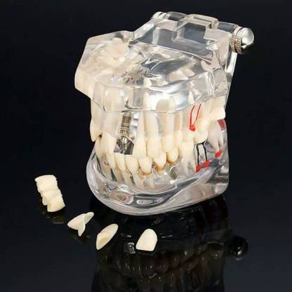 ADSC Dental All In One Study Model(Feature- Dental Implants Crown and Bridge Ab fraction Root Canal Caries ) Dental Elevator