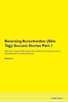 Reversing Acrochordon (Skin Tag)