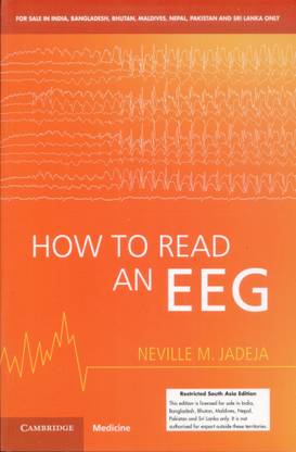 How to Read An EEG