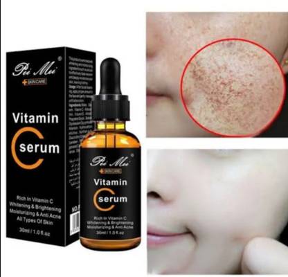 Pei Mei Vitamic c whitening moisturizing anti acne serum