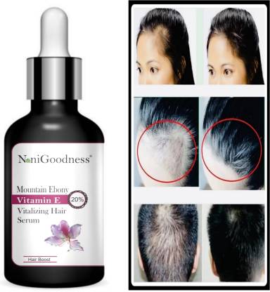 NoniGoodness Mountain Ebony vitalizing serum for falling hair