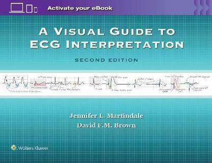 A Visual Guide to ECG Interpretation