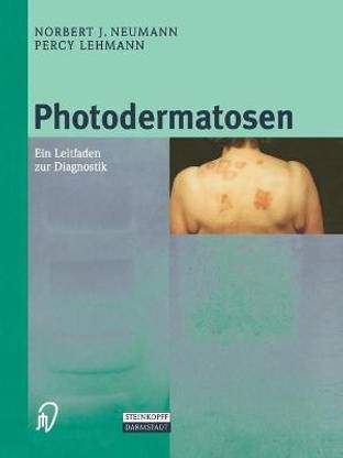 Photodermatosen