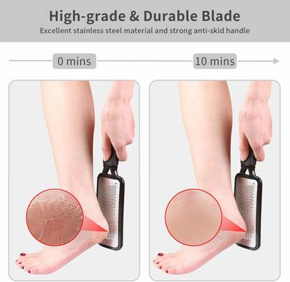 Rikans Stainless Steel Pro Footcare Colossal Rasp Foot File and Callus Remover