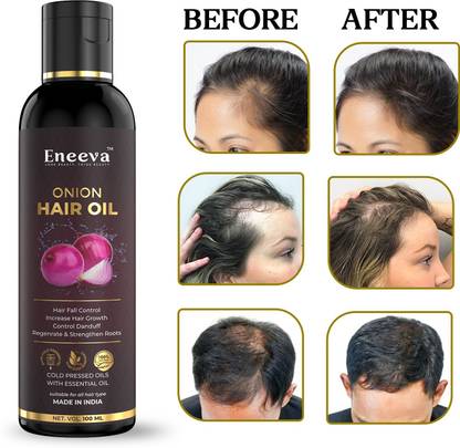 eneeva Onion Hair Oil - Controls Hair Fall - NO Mineral Oil, Silicones, 100 ML Hair Oil