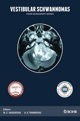 Vestibular Schwannomas