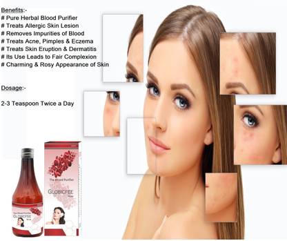 अतुल्य मेडिलिंक एक्ने, पिंपल, एलर्जी स्किन लेसन और फोड़े के लिए आयुर्वेदिक सिरप