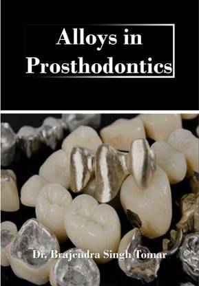 Alloys in Prosthodontics