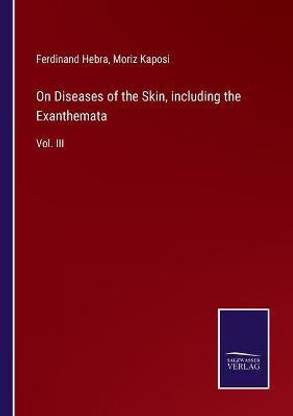On Diseases of the Skin, including the Exanthemata
