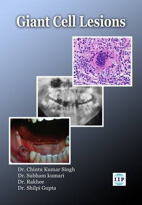 Giant Cell Lesions