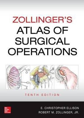 Zollinger's Atlas of Surgical Operations, Tenth Edition  - Atlas of Surgical Operations