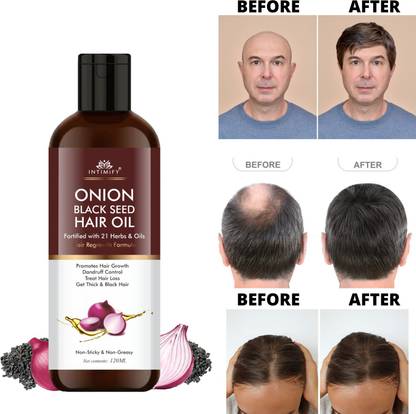 INTIMIFY Onion Black Seed Hair Oil For Hair Growth, Dandruff Control & Anti hair fall Hair Oil
