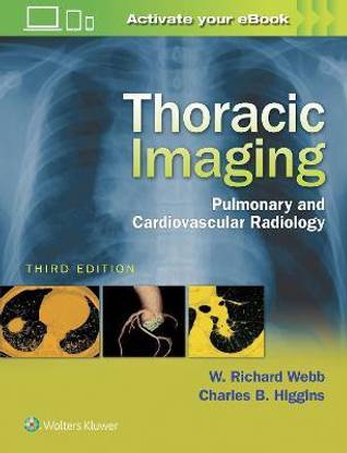 Thoracic Imaging