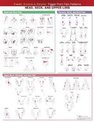 Travell, Simons & Simons' Trigger Point Pain Patterns Wall Chart