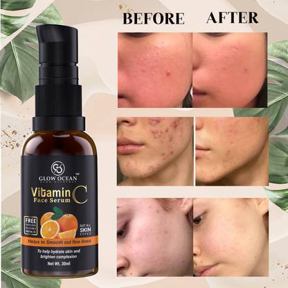 glowocean Vitamin C Serum -For Skin Repair, Dark Spot, Pimple Removal Face Serum