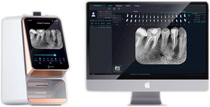 Ids PSP SCANNER I SCAN X-Ray Viewer