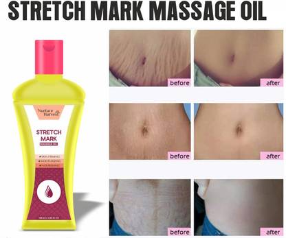 Nurture Harvest STRETCH MARKS OIL TO REDUCE STRETCH MARKS AND EVEN SKIN TONE (100ML)