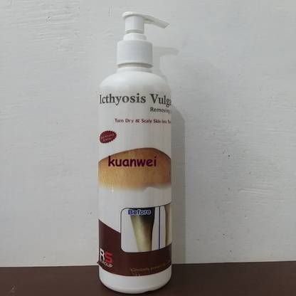 kuanwei icthyosis_vulgaris_removing_lotion_500ml