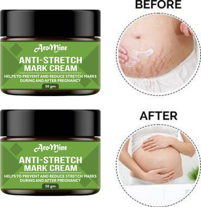 AroMine Anti Stretch Marks Cream to Reduce Stretch Marks & Scars-50gm-2-Jar-