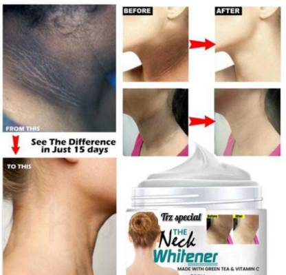 Cemera Neck Back Elbow Whitening Cream For Remove Black Spots & Warts-50gm Body Creams