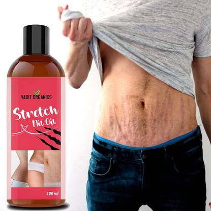 Vadit organics stretch mark removal oil Men under arms stretch mark bio oil and Scars Removal
