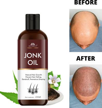 INTIMIFY Leech Oil (Jonk Oil) For Hair Growth Oil Men & Women, Anti Dandruff, Hair Fall Hair Oil