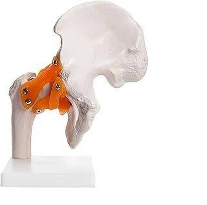 EMEDI LT-34 Human Hip Joint Model Anatomical Body Model