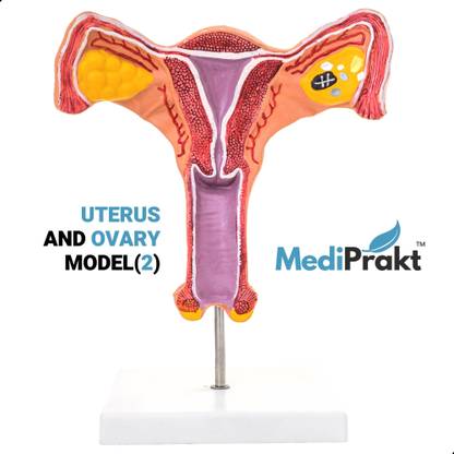 MediPrakt UTERUS & OVARY MODEL (2) | Pathological | Female Reproductive Organ | Anatomical Body Model