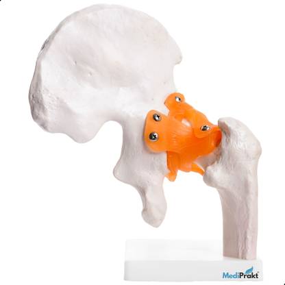MediPrakt | LIFE SIZE HIP JOINT MODEL | With Ligaments | For Demonstration & Orthopedic Use | Anatomically Accurate | Anatomical Body Model